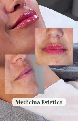 medicina estética22